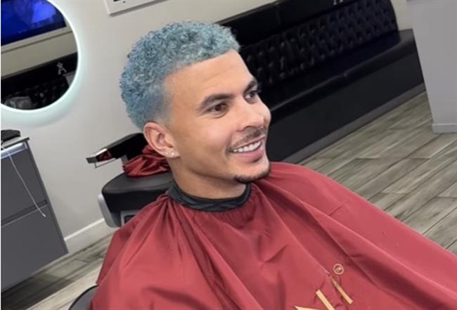 Dele Alli gây chú ý với CĐV Everton khi thay đổi màu tóc