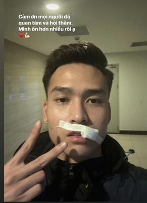 Bùi Hoàng Việt Anh cập nhật tình hình sau chấn thương 1