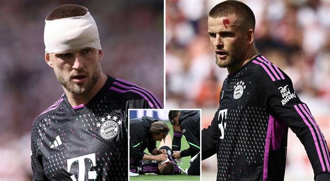 Eric Dier đổ máu sau pha cứu thua ngay trên vạch vôi