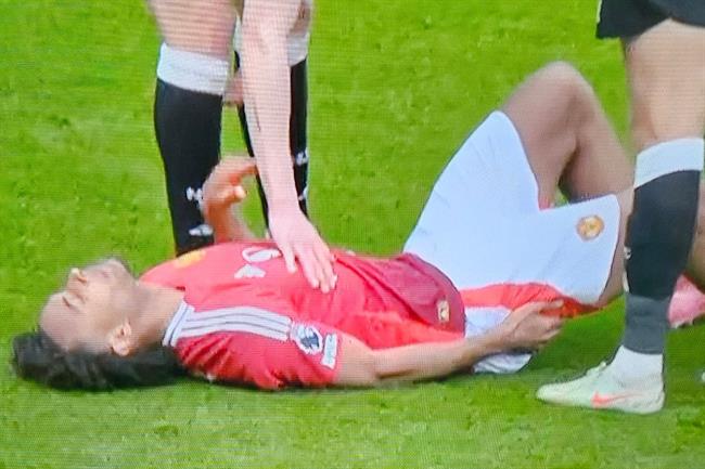 MU nhận tin sét đánh trước trận gặp Lyon