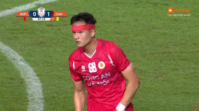 Bùi Hoàng Việt Anh phải khâu 14 mũi