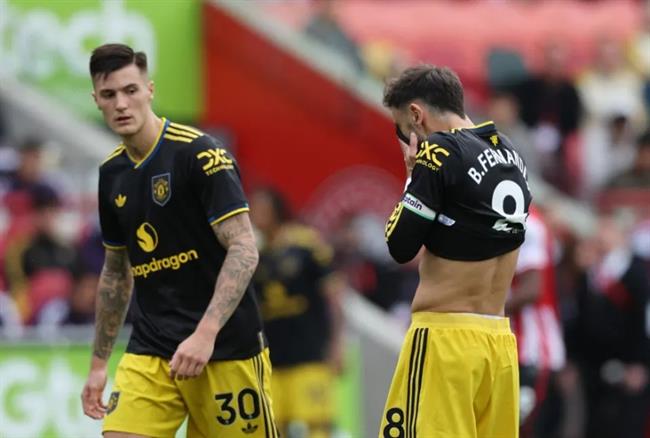 Khi bóng bổng là “tử huyệt” của Man United