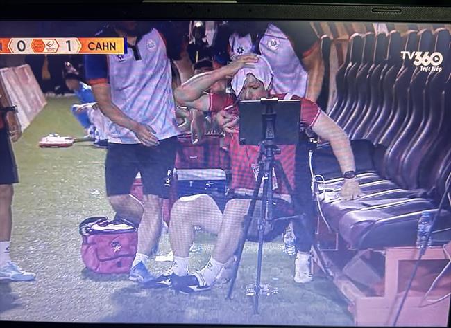 Trợ lý CAHN choáng váng vì bị ngoại binh Đà Nẵng đẩy