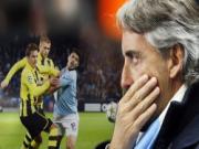 Man City: Gã khổng lồ chân đất sét