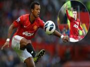 Arsenal mong Man Utd bán “rẻ” Nani