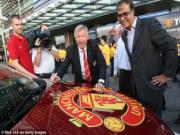 Tình hình tài chính tại M.U: Những dấu hiệu khả quan