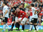 Wayne Rooney đã xuất viện