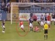 Chấn thương kinh hoàng: Gãy chân sau cú kê chân của đối thủ