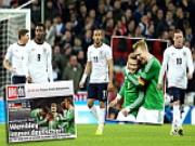 Tuyển Anh thua đội hình hai của Đức: Tam sư đáng bị xem thường