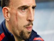 “Lội ngược dòng” thần kỳ trước Ukraine, Ribery tự tin có thể... vô địch World Cup?