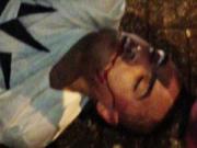 Cựu cầu thủ M.U bị đánh bất tỉnh trên phố