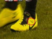 Nghi án anh em nhà Da Silva đổi vị trí cho nhau