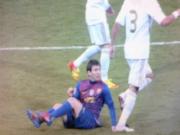 Vì sao vụ việc Pepe giẫm lên tay Messi bị ỉm đi?