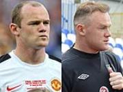 Rooney đi cấy tóc lần hai