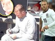 Anh - Moldova, còn 1 ngày: Roy Hodgson giữa cơn bão chấn thương