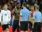 Welbeck bị treo giò, Hodgson lo sốt vó