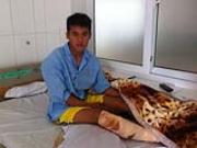 Cầu thủ V-League bị đạp gãy chân phải dưỡng thương gần một năm