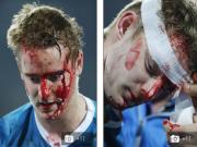 Lewandowski "phang" đối thủ máu me be bét