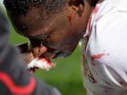 Ghana sẽ thua trắng 3 trận vòng bảng vì bị "trù ẻo"