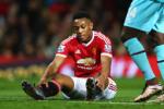 Anthony Martial: Bản hợp đồng thất bại của Van Gaal?