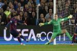 Joe Hart tiết lộ bí quyết thi đấu “lên thần” trước Messi