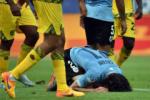 Sát thủ Cavani có thể phải chia tay Copa America 2015