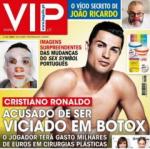 Cristiano Ronaldo nghiện làm đẹp bằng bơm botox