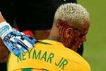 Ngôi sao Neymar dính phải pha “gạt tay vào má” kinh hoàng