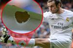 Giải mã điều bất ngờ đằng sau chiếc tất thủng của Gareth Bale