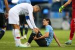Cavani lên tiếng về chấn thương trong trận thắng Bồ Đào Nha
