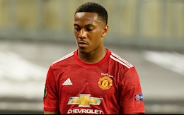 Chuyện gì đang xảy ra với Anthony Martial?