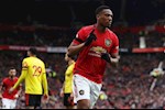 "Anthony Martial sẽ trở thành cầu thủ đẳng cấp hàng đầu thế giới nếu..."