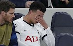 Lấy virus corona ra nhạo báng, sao Tottenham sắp bị phạt