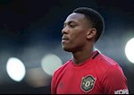 Đây! Lý do Martial chưa bùng nổ ở MU