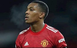 Solskjaer thừa nhận Martial xứng đáng phải nhận chỉ trích
