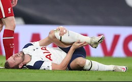 Tottenham thiệt đơn thiệt kép: Thêm Harry Kane dính chấn thương