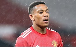 Đây! Phản ứng của Solskjaer với Martial ít phút trước thảm hoạ