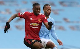 Wan-Bissaka tỏ ra hãnh diện khi hành hạ Sterling