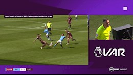 Raheem Sterling thoát thẻ đỏ khó tin trước Leeds