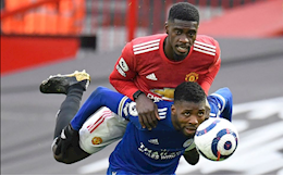 Tuanzebe đeo Apple Watch thi đấu trước Leicester?