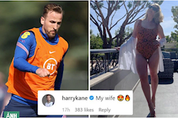 Vợ khoe thân mình khiến Harry Kane choáng váng