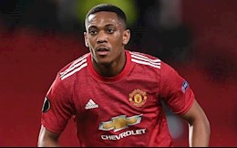 Anthony Martial xuất hiện với hình ảnh lạ lẫm