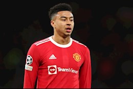 Rangnick không rõ lý do Lingard vắng mặt trước Middlesbrough