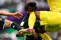 Hậu vệ Saudi Arabia dính chấn thương kinh hoàng, sớm chia tay World Cup 2022