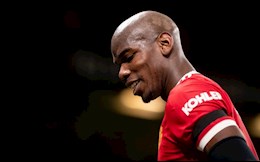 Paul Pogba bị trộm lấy mất huy chương vàng World Cup