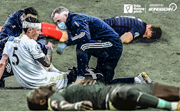 Những chấn thương vùng đầu: Sát thủ vô hình trong bóng đá