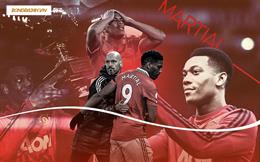 Anthony Martial và câu chuyện Golden Boy trong tủ kính