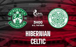 Nhận định Hibernian vs Celtic 3h00 ngày 8/2 (VĐQG Scotland 2023/24)