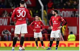 Alan Pardew chỉ ra sai lầm của MU trên TTCN